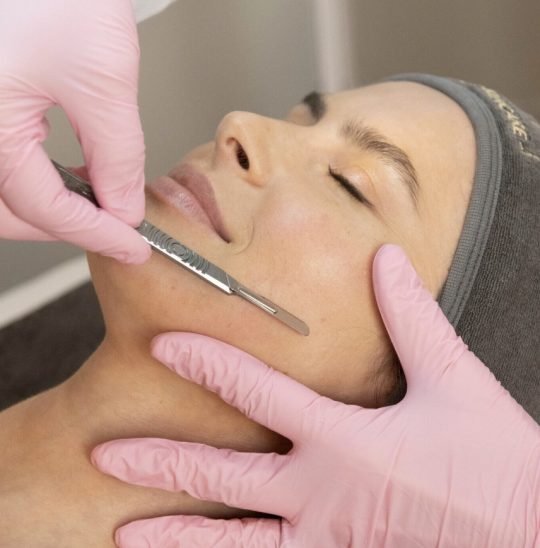 DERMAPLANING