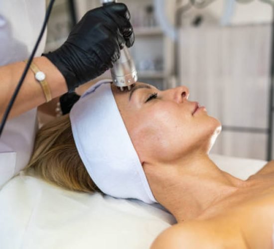 Woman getting rf-lifting on face