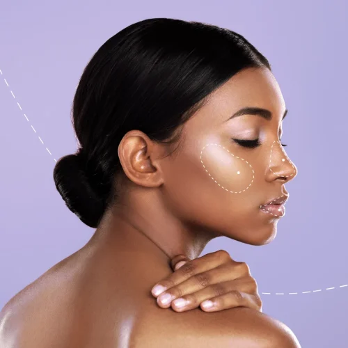 fillers-social fillers-social