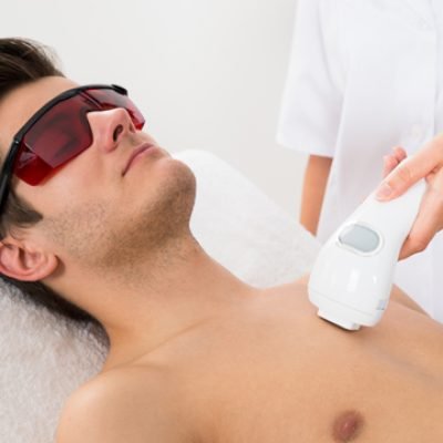 laser-hair-removal